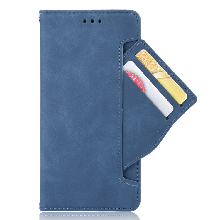 For Doogee X96 Pro Skin Feel Calf Pattern Horizontal Flip Leather Case with Holder & Card Slots & Photo Frame(Blue) - More Brand by buy2fix | Online Shopping UK | buy2fix