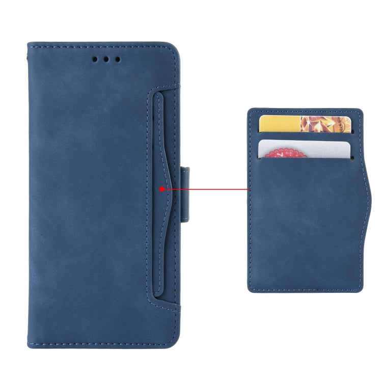 For Doogee X96 Pro Skin Feel Calf Pattern Horizontal Flip Leather Case with Holder & Card Slots & Photo Frame(Blue) - More Brand by buy2fix | Online Shopping UK | buy2fix